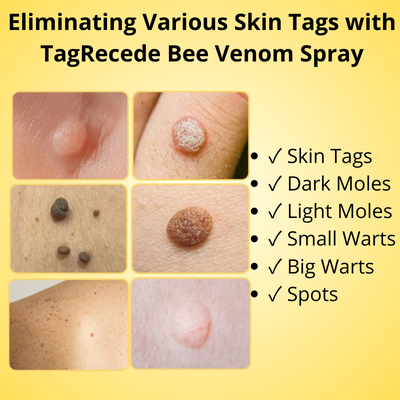 TagRecede Bee Venom Treatment Spray